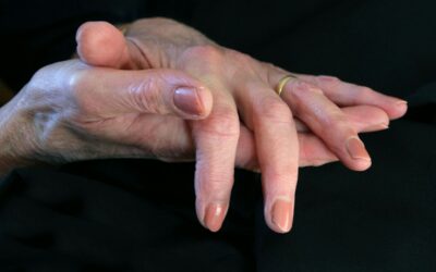 CBD y artritis: inflamación y movilidad
