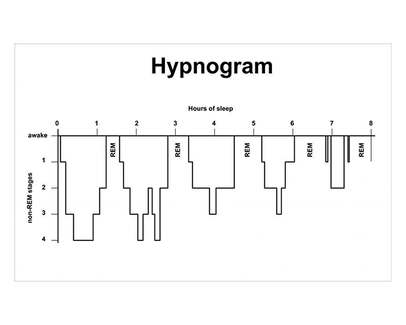 Arquitectura del sueño: ciclos NREM y REM a lo largo de la noche